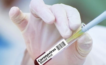 COVID-védőoltás: A legfontosabb információk egy helyen!